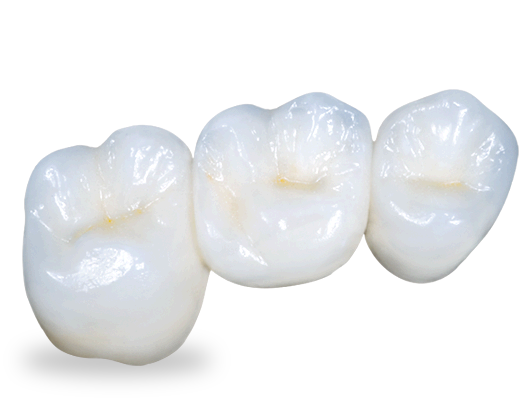 The Facts About All Porcelain and Cubic Zirconia Crowns The Facts About All Porcelain and Cubic Zirconia Crowns