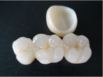 What Causes Poor Marginal Fit in CAD/CAM Zirconia Crowns?