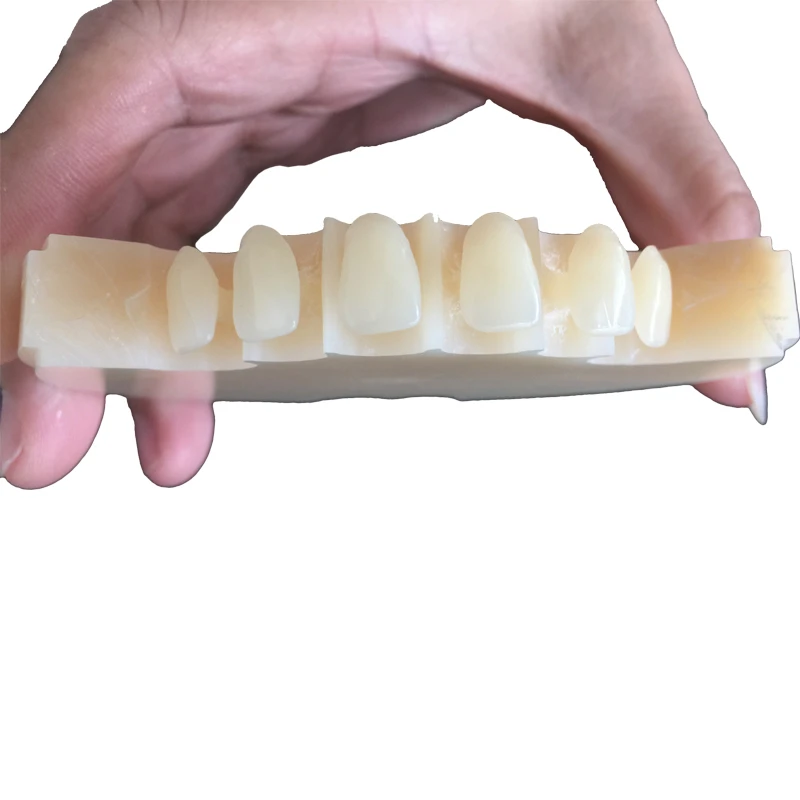What Is PMMA Material in Dentistry? What Is PMMA Material in Dentistry?